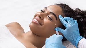 Botox: A Modern Approach to Timeless Beauty